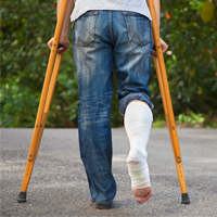 Ankle Injuries from Slip and Falls