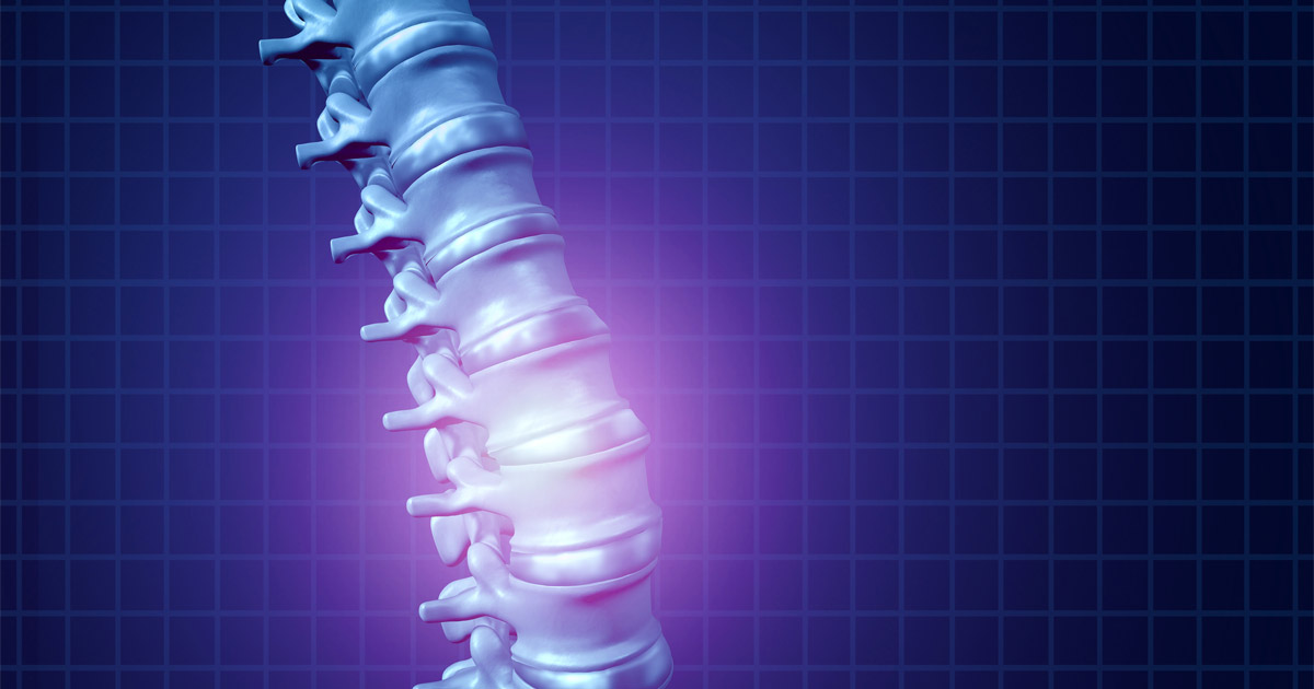 What Should You Do if You Have a Spinal Cord Injury From an Accident?